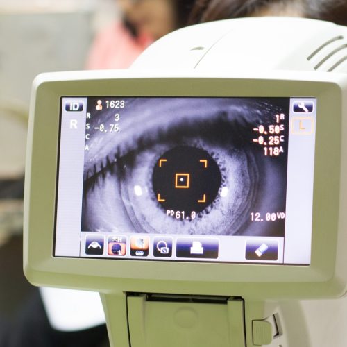 Centro Glaucoma Roma