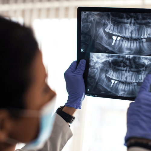 IMPLANTOLOGIA DENTALE A MAZZARINO