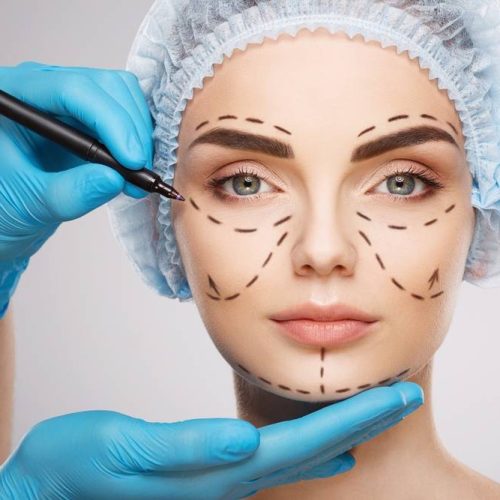 Laserterapia Colleferro