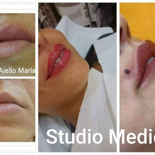Medicina estetica a Catanzaro