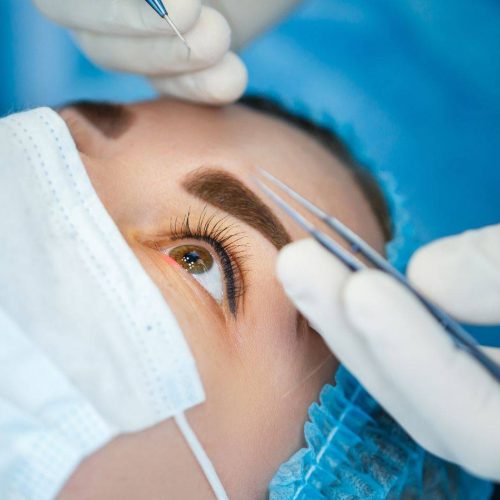 Intervento Laser per Miopia a Macerata: Correggi la Tua Vista con la Tecnologia Avanzata