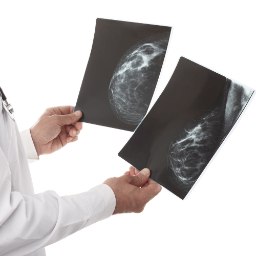 Mammografie a Tricase