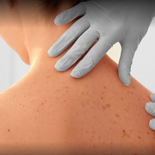 Chirurgia dermatologica a Legnago