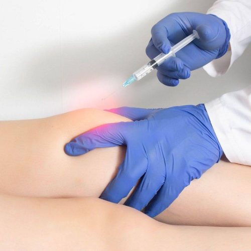 OZONOTERAPIA A UDINE