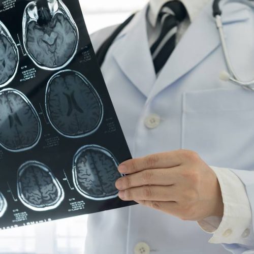 Visita neurologica a Sanremo