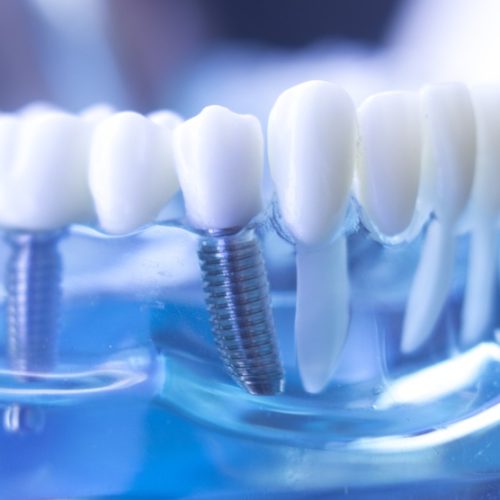 BIOTECNOLOGIE DENTALI SU MILANO